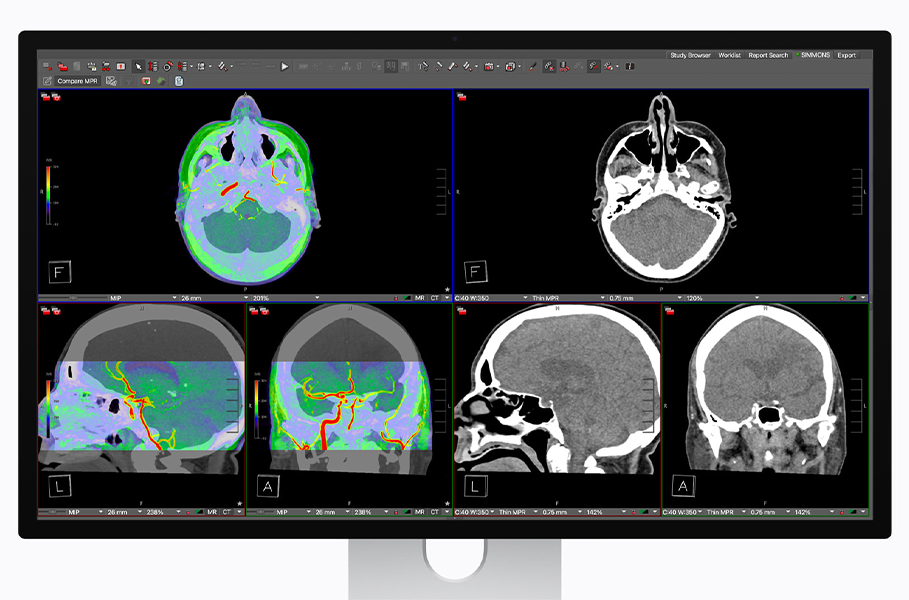 Монітор Apple Studio Display XDR 27